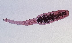 Echinococcus granulosus